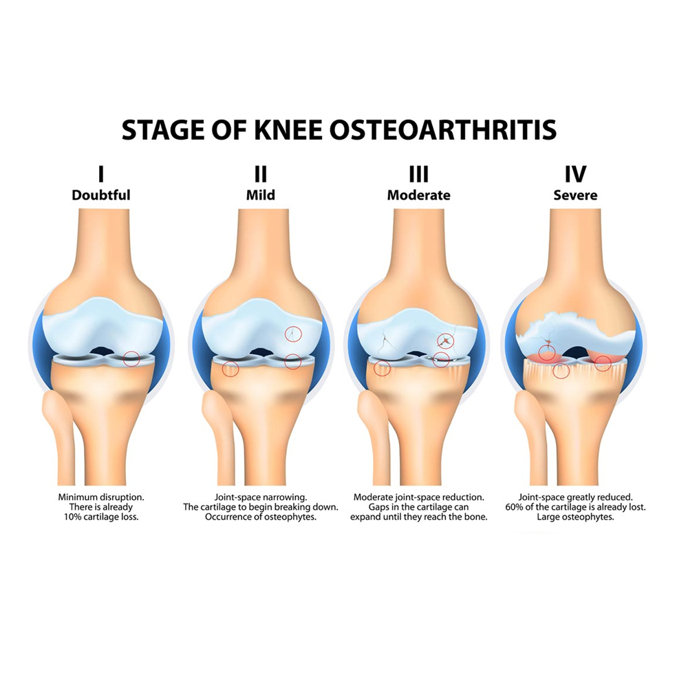 Bio-Glucosamine MEGA 60 tabs - Image 2